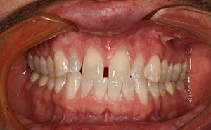 before cosmetic dental treatment