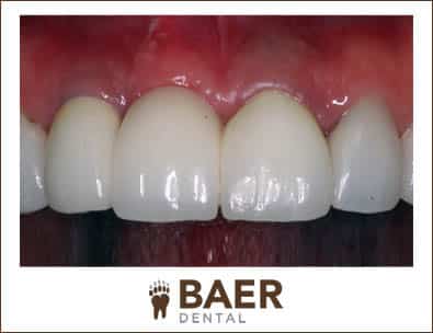 Baer Dental Designs 5