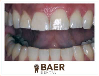 Baer Dental Designs 9