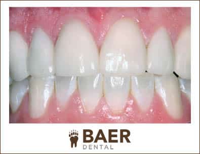 Baer Dental Designs 8